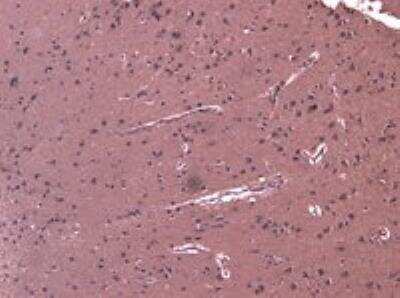 Immunohistochemistry-Paraffin: DHX58 Antibody [NBP1-20939] - Staining of paraffin embedded Human Cortex. Antibody at 8 ug/mL. Heat induced antigen retrieval with citrate buffer pH 6, HRP-staining.