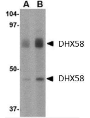 Western Blot: DHX58 Antibody [NBP1-76389] - Rat kidney tissue lysate with DHX58 antibody at (A) 1 and (B) 2 ug/ml.