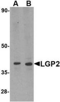 Western Blot: DHX58 Antibody [NBP1-76390] - MDA-MB-361 cell lysate with LGP2 antibody at (A) 0.5 and (B) 1 ug/mL.