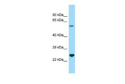 Western Blot: DIA1 Antibody [NBP3-10632] - Western blot analysis of DIA1 in Mouse Testis as a positive control. Antibody dilution at 1.0 ug/ml