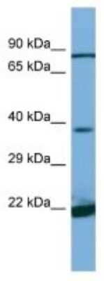 Western Blot: DIA1 Antibody [NBP3-10633] - Western blot analysis of DIA1 in Jurkat Whole Cell lysates. Antibody dilution at 1.0ug/ml