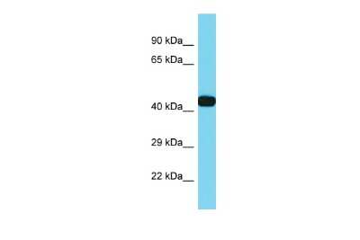 Western Blot: DIA1R Antibody [NBP2-82853] - Host: Rabbit. Target Name: CXorf36. Sample Type: Hela Whole cell lysates. Antibody Dilution: 1.0ug/ml