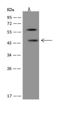 Western Blot: DIA1R Antibody [NBP3-05988] - DIA1R antibody at 1:500 dilutionLane A: Hela Whole Cell LysateLysates/proteins at 30 ug per lane.Secondary: Goat Anti-Rabbit IgG (H+L) HRP at 110000 dilution.Developed using the ECL technique.Performed under reducing conditions.Predicted band size: 49 kDa
