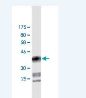 Western Blot: DIAPH1 Antibody (1A8) [H00001729-M02] - Detection against Immunogen (37.18 KDa) .