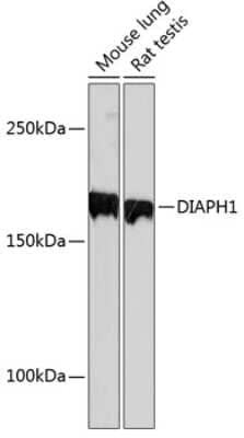 Western Blot: DIAPH1 Antibody (6N10D0) [NBP3-15410] - Western blot analysis of extracts of various cell lines, using DIAPH1 Rabbit mAb (NBP3-15410) at 1:1000 dilution. Secondary antibody: HRP Goat Anti-Rabbit IgG (H+L) at 1:10000 dilution. Lysates/proteins: 25ug per lane. Blocking buffer: 3% nonfat dry milk in TBST. Detection: ECL Basic Kit. Exposure time: 90s.