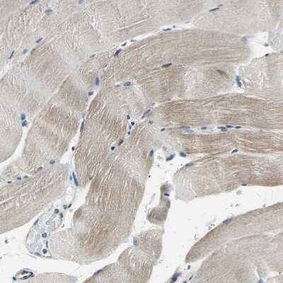 Immunohistochemistry-Paraffin: DIAPH1 Antibody [NBP1-85246] - Staining of human skeletal muscle shows weak cytoplasmic positivity in myocytes.