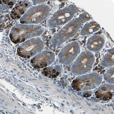 Immunohistochemistry-Paraffin: DIAPH1 Antibody [NBP1-85246] - Staining of human small intestine shows strong cytoplasmic positivity in glandular cells.