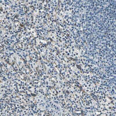 Immunohistochemistry-Paraffin: DIAPH1 Antibody [NBP1-85246] - Staining of human spleen shows moderate cytoplasmic positivity in sinusoids.