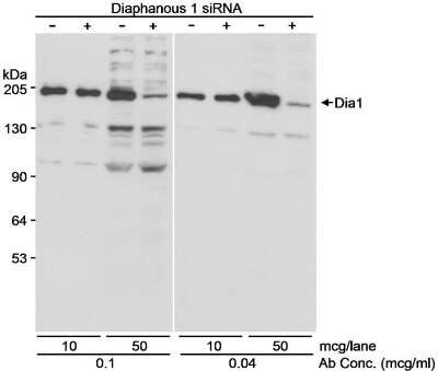 <b>Independent Antibodies Validation and Genetic Strategies Validation.</b>Western Blot: DIAPH1 Antibody [NB600-230] - Whole cell lysate (10 or 50 ug/lane) from untreated or siRNA treated 293T cells. Antibody used at 0.1 and 0.04 ug/ml.