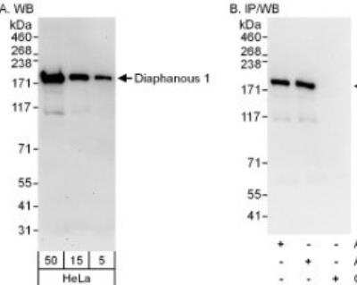 Western Blot: DIAPH1 Antibody [NB600-230] - Samples: Whole cell lysate (5, 15 and 50 ug for WB; 1 mg for IP, 20% of IP loaded) from HeLa cells. Antibodies: Affinity purified rabbit anti-Diaphanous 1 antibody used for WB at 0.04 ug/ml (A) and 1 ug/ml (B) and used for IP at 3 ug/mg lysate. Diaphanous 1 was also immunoprecipitated by a prior lot of this antibody. Detection: Chemiluminescence with exposure times of 30 seconds (A) and 1 second (B).