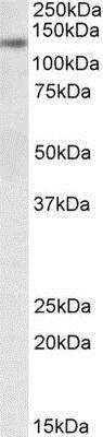 Western Blot: DIAPH1 Antibody [NBP1-47202] - Analysis of NIH3T3 lysate (35ug protein in RIPA buffer) using NBP1-47202 at 0.3ug/ml. Primary incubation was 1 hour. Detected by chemiluminescence.