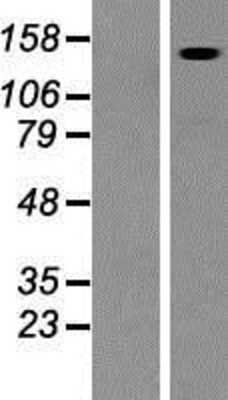 Western Blot: DIAPH1 Overexpression Lysate (Adult Normal) [NBP2-08476] Left-Empty vector transfected control cell lysate (HEK293 cell lysate); Right -Over-expression Lysate for DIAPH1.