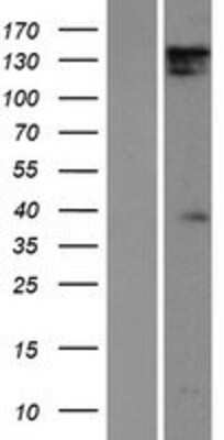 Western Blot: DIAPH1 Overexpression Lysate (Adult Normal) [NBP2-09814] Left-Empty vector transfected control cell lysate (HEK293 cell lysate); Right -Over-expression Lysate for DIAPH1.