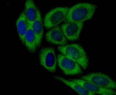 Immunocytochemistry/Immunofluorescence: DIAPH3 Antibody [NBP2-80419] - Staining DIAPH3 in SiHa cells (green). The nuclear counter stain is DAPI (blue). Cells were fixed in paraformaldehyde, permeabilized with 0.25% Triton X100/PBS.