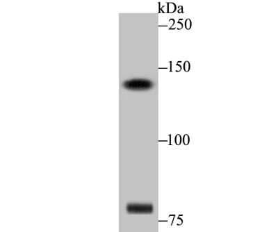 Western Blot: DIAPH3 Antibody [NBP2-80419] - Analysis of DIAPH3 on SiHa cell lysate using anti-DIAPH3 antibody at 1/500 dilution.