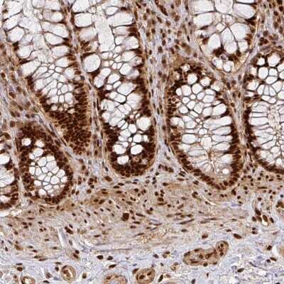 Immunohistochemistry-Paraffin: DIDO1 Antibody [NBP2-33269] - Staining of human rectum shows strong nuclear positivity in glandular cells.