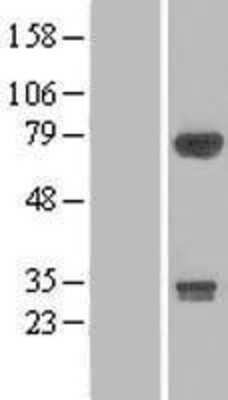 Western Blot DIP13B Overexpression Lysate