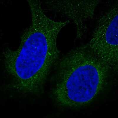 Immunocytochemistry/Immunofluorescence: DIP2B Antibody [NBP2-58276] - Staining of human cell line U-2 OS shows localization to endoplasmic reticulum. Antibody staining is shown in green.