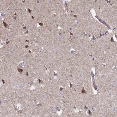 Immunohistochemistry-Paraffin: DIP2B Antibody [NBP2-14563] - Staining of human cerebral cortex shows moderate cytoplasmic positivity in neuronal cells.