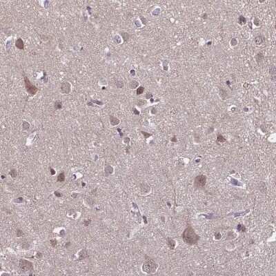 Immunohistochemistry-Paraffin: DIP2B Antibody [NBP2-38779] - Staining of human cerebral cortex shows moderate cytoplasmic positivity in neuronal cells.