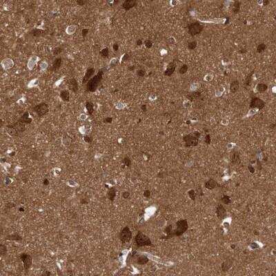 Immunohistochemistry-Paraffin: DIP2C Antibody [NBP1-81461] - Staining of human cerebral cortex shows strong cytoplasmic and nuclear positivity in neuronal cells.