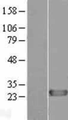 Western Blot: DIRAS1 Overexpression Lysate (Adult Normal) [NBL1-09889] Left-Empty vector transfected control cell lysate (HEK293 cell lysate); Right -Over-expression Lysate for DIRAS1.