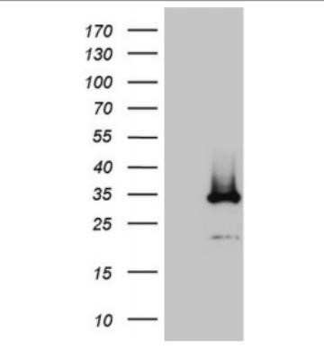 Western Blot: DIRAS2 Antibody (OTI10H1) - Azide and BSA Free [NBP2-71967] - HEK293T cells were transfected with the pCMV6-ENTRY control (Left lane) or pCMV6-ENTRY DIRAS2 (Right lane) cDNA for 48 hrs and lysed. Equivalent amounts of cell lysates (5 ug per lane) were separated by SDS-PAGE and immunoblotted with antiDIRAS2.(1:2000)