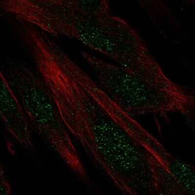 Immunocytochemistry/ Immunofluorescence DIRC1 Antibody - BSA Free