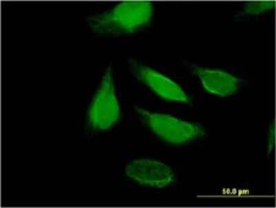 Immunocytochemistry/Immunofluorescence: DIS3 Antibody (2C7) [H00022894-M01] - Analysis of monoclonal antibody to DIS3 on HeLa cell . Antibody concentration 10 ug/ml.