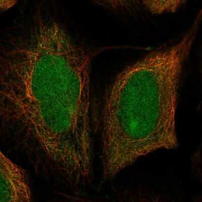 Immunocytochemistry/Immunofluorescence: DIS3 Antibody [NBP1-85209] - Staining of human cell line U-2 OS shows localization to nucleus & cytosol. Antibody staining is shown in green