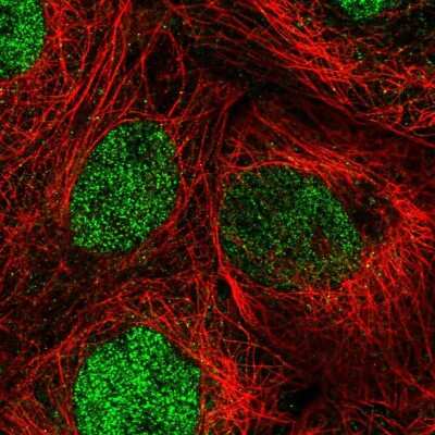 Immunocytochemistry/Immunofluorescence: DIS3 Antibody [NBP2-55359] - Staining of human cell line A-431 shows localization to nucleoplasm.