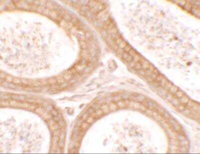 Immunohistochemistry: DIS3 Antibody [NBP2-81804] - Immunohistochemistry of DIS3 in mouse testis tissue with DIS3 antibody at 2.5 ug/ml. 