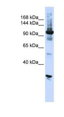 Western Blot: DIS3 Antibody [NBP1-57189] - Hela cell lysate, concentration 0.2-1 ug/ml.