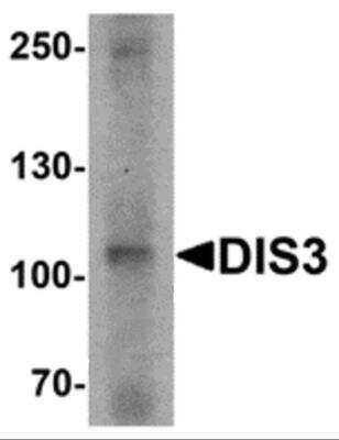 Western Blot: DIS3 Antibody [NBP2-81804] - Analysis of DIS3 in human ovary tissue lysate with DIS3 antibody at 1 ug/ml.