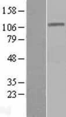 Western Blot: DIS3 Overexpression Lysate (Adult Normal) [NBL1-09892] Left-Empty vector transfected control cell lysate (HEK293 cell lysate); Right -Over-expression Lysate for DIS3.