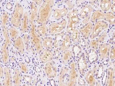 Immunohistochemistry-Paraffin: DIS3L Antibody [NBP2-97612] - Immunochemical staining of human DIS3L in human kidney with rabbit polyclonal antibody at 1:100 dilution, formalin-fixed paraffin embedded sections.