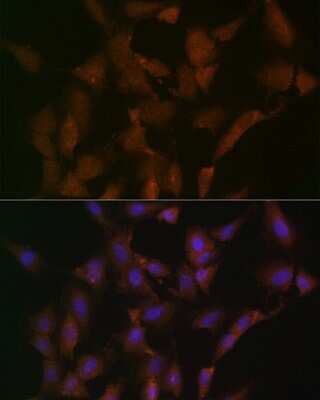 Immunocytochemistry/Immunofluorescence: DISC1 Antibody (4U5N1) [NBP3-16462] - Immunofluorescence analysis of C6 cells using DISC1 Rabbit mAb (NBP3-16462) at dilution of 1:100 (40x lens). Blue: DAPI for nuclear staining.