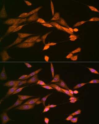 Immunocytochemistry/Immunofluorescence: DISC1 Antibody (4U5N1) [NBP3-16462] - Immunofluorescence analysis of NIH-3T3 cells using DISC1 Rabbit mAb (NBP3-16462) at dilution of 1:100 (40x lens). Blue: DAPI for nuclear staining.