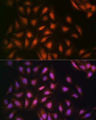 Immunocytochemistry/Immunofluorescence: DISC1 Antibody (4U5N1) [NBP3-16462] - Immunofluorescence analysis of U-2 OS cells using DISC1 Rabbit mAb (NBP3-16462) at dilution of 1:100 (40x lens). Blue: DAPI for nuclear staining.