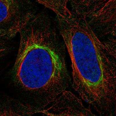 Immunocytochemistry/Immunofluorescence: DISC1 Antibody [NBP2-76538] - Staining of human cell line U-2 OS shows localization to intermediate filaments. Antibody staining is shown in green.