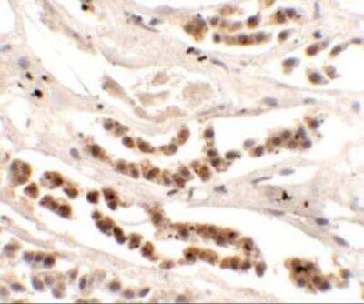 Immunohistochemistry: DISP1 Antibody [NBP2-81818] - Immunohistochemistry of DISP1 in human kidney tissue with DISP1 antibody at 2.5 ug/mL.
