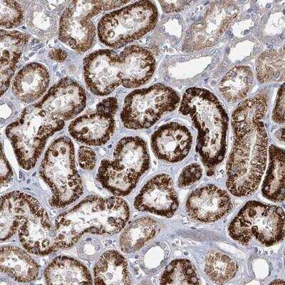 Immunohistochemistry-Paraffin: DISP1 Antibody [NBP2-13925] - Staining of human kidney shows strong cytoplasmic positivity in tubule cells.