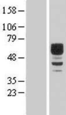 Western Blot: DIXDC1 Overexpression Lysate (Adult Normal) [NBL1-09896] Left-Empty vector transfected control cell lysate (HEK293 cell lysate); Right -Over-expression Lysate for DIXDC1.