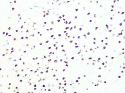 Immunohistochemistry-Paraffin: DKC1 Antibody (2W2V6) [NBP3-16405] - Immunohistochemistry of paraffin-embedded rat brain using DKC1 Rabbit mAb (NBP3-16405) at dilution of 1:100 (40x lens).Perform microwave antigen retrieval with 10 mM PBS buffer pH 7.2 before commencing with IHC staining protocol.