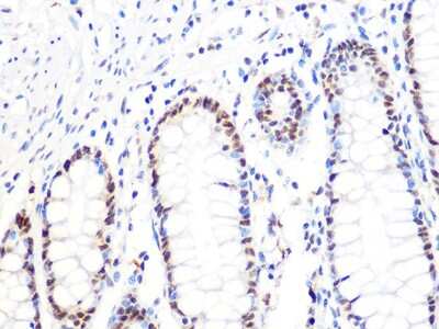 Immunohistochemistry-Paraffin: DKC1 Antibody (2W2V6) [NBP3-16405] - Immunohistochemistry of paraffin-embedded human colon using DKC1 Rabbit mAb (NBP3-16405) at dilution of 1:100 (40x lens).Perform microwave antigen retrieval with 10 mM PBS buffer pH 7.2 before commencing with IHC staining protocol.