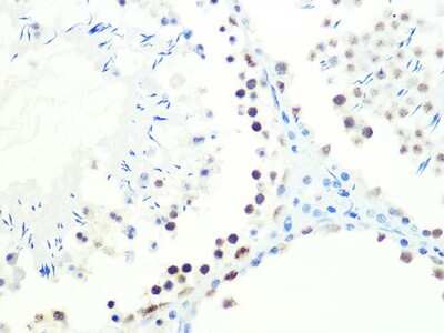 Immunohistochemistry-Paraffin: DKC1 Antibody (2W2V6) [NBP3-16405] - Immunohistochemistry of paraffin-embedded mouse testis using DKC1 Rabbit mAb (NBP3-16405) at dilution of 1:100 (40x lens).Perform microwave antigen retrieval with 10 mM PBS buffer pH 7.2 before commencing with IHC staining protocol.