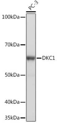 Western Blot: DKC1 Antibody (2W2V6) [NBP3-16405] - Western blot analysis of extracts of PC-3 cells, using DKC1 Rabbit mAb (NBP3-16405) at 1:1000 dilution. Secondary antibody: HRP Goat Anti-Rabbit IgG (H+L) at 1:10000 dilution. Lysates/proteins: 25ug per lane. Blocking buffer: 3% nonfat dry milk in TBST. Detection: ECL Basic Kit. Exposure time: 1s.