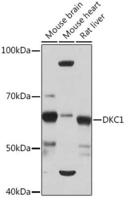 Western Blot: DKC1 Antibody (2W2V6) [NBP3-16405] - Western blot analysis of extracts of various cell lines, using DKC1 Rabbit mAb (NBP3-16405) at 1:1000 dilution. Secondary antibody: HRP Goat Anti-Rabbit IgG (H+L) at 1:10000 dilution. Lysates/proteins: 25ug per lane. Blocking buffer: 3% nonfat dry milk in TBST. Detection: ECL Basic Kit. Exposure time: 10s.