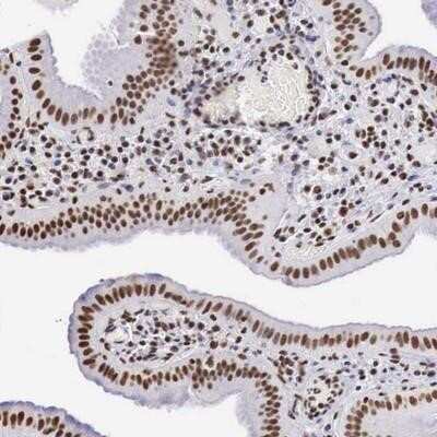 Immunohistochemistry-Paraffin: DKC1 Antibody [NBP1-85155] - Staining of human gall bladder shows distinct nuclear positivity in glandular cells.