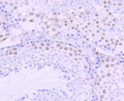 Immunohistochemistry-Paraffin: DKC1 Antibody (JU34-32) [NBP2-75472] - Analysis of paraffin-embedded mouse testis tissue using anti-DKC1 antibody. Counter stained with hematoxylin.